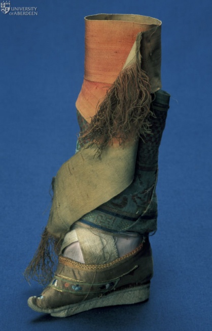 Model of the foot of a Chinese female, in plaster of Paris, with silk bandage and shoe- ABDUA 63760