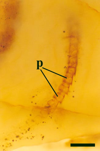A leg appendage of Heterocrania rhyniensis, showing the individual box-shaped podomeres (p) (scale bar = 250μm).