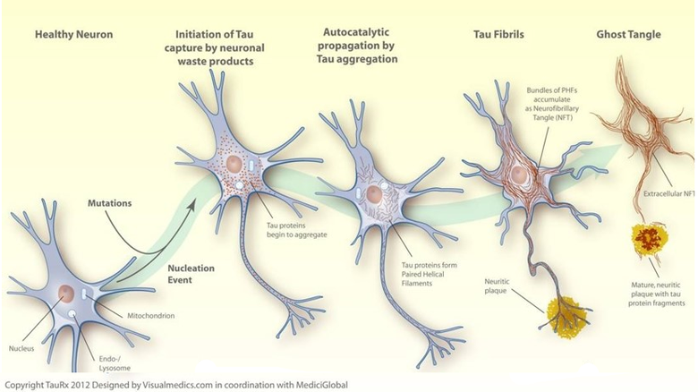 Diagrammatic representation of tau protein aggregation inside neuronal cells leading to cellular dysfunction and cell death