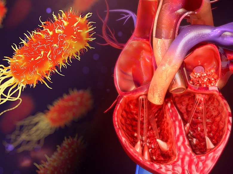 Human heart and bacteria