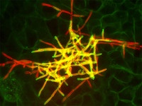 Candida albicans growing within human epithelia