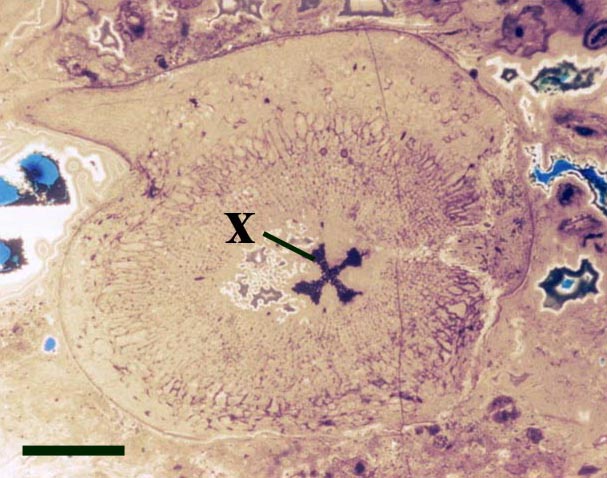 Transverse cross-section through a prostrate aerial axis of Asteroxylon showing the distinctive lobed stellate xylem strand (x) (scale bar = 2mm).