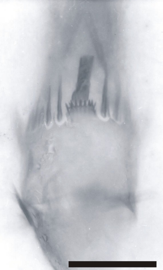 Close-up of an exopod segment on a second antenna showing the single long seta, broken in this case (above centre) and the disposition of the finer setae surrounding it (scale bar = 50mm). Copyright owned by the University of Aberdeen.