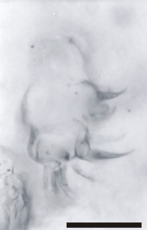 Isolated mandible coxa showing the array of spine-like setae (scale bar = 50mm). Copyright owned by the University of Aberdeen.