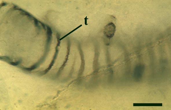 A thin-walled tube of Nematoplexus with spiral thickenings (t) (scale bar = 10µm) (Copyright owned by University of Münster).