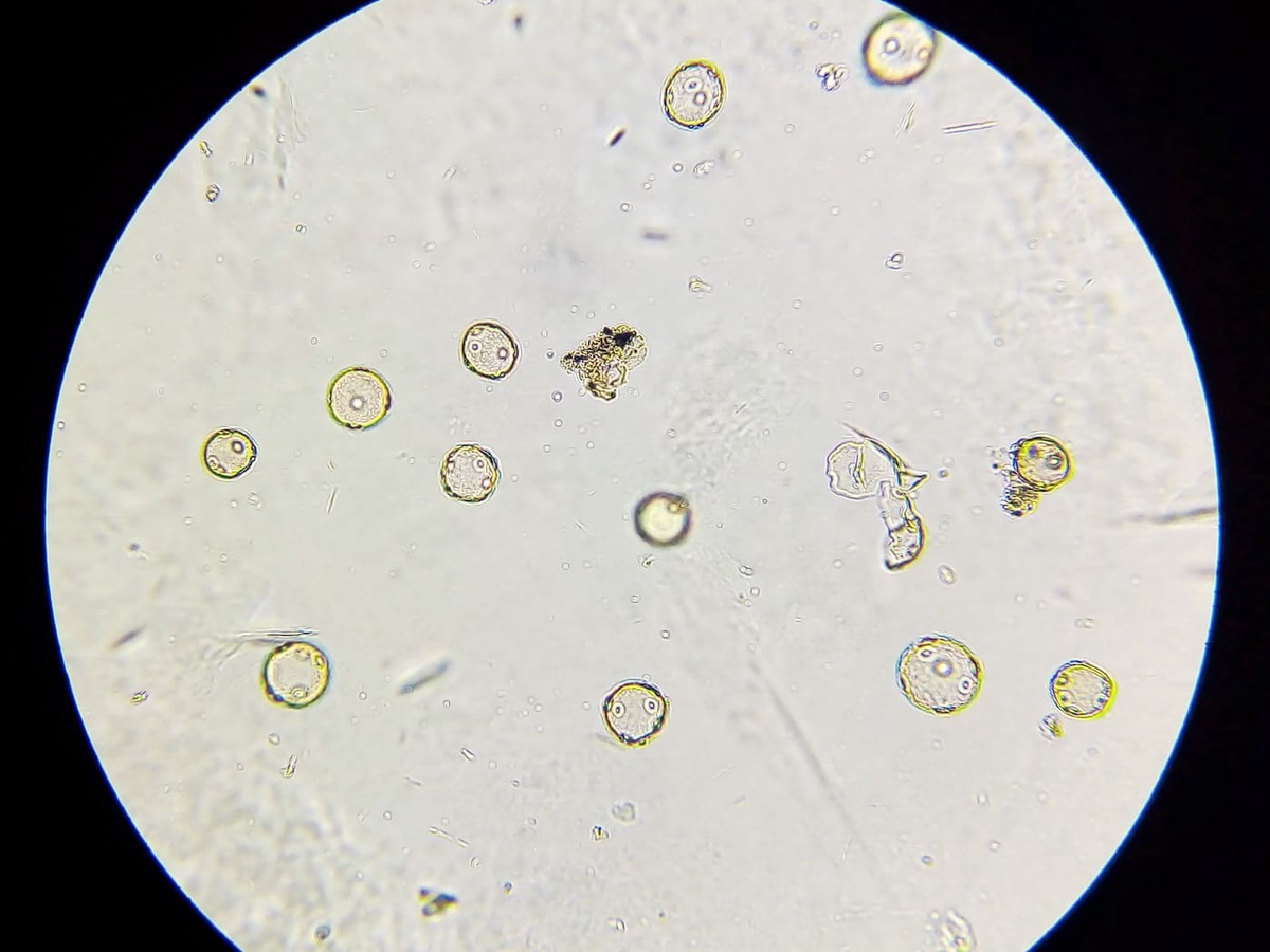 pollen under a microscope