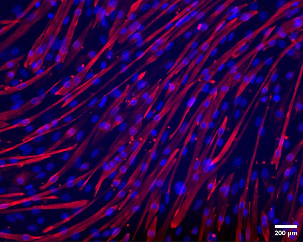 Standard 24 well-plate culture of mouse muscle cells (C2C12). Mature muscle fibres stained red using Desmin (long structures) and blue using Hoescht (blobs). Image: Amrita Debnath / Claudiu Giuraniuc