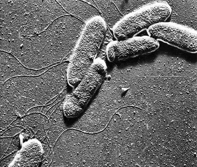 bacteria under microscope