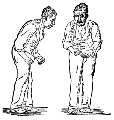 Gentleman with Parkinson's disease