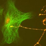DRG growth cone crosses astrocyte