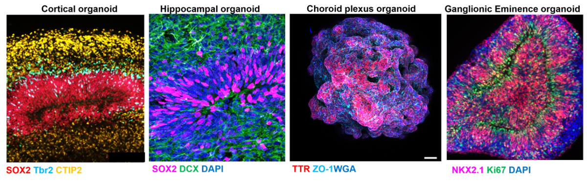 brain region specific organoids 2.png