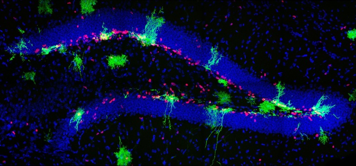 Neural Stem cells in the adult dentate gyrus