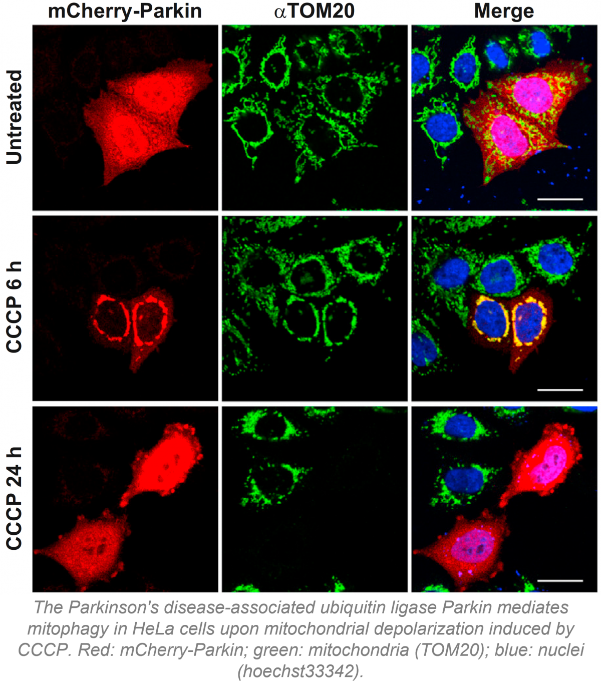 Parkin-mediated mitophagy - Cell Rep 2014-2.png