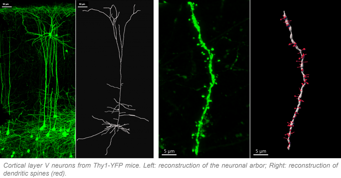 Arbor-spines reconstructions.png