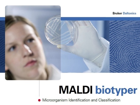 MALDI Biotyper