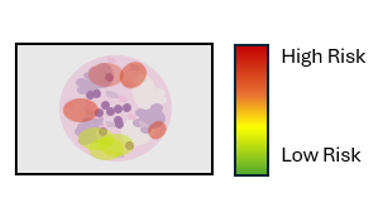 3. Areas flagged as potentially high for cancer returning