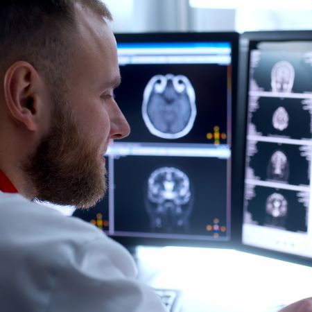 A man looking at brain scans on two computer screens
