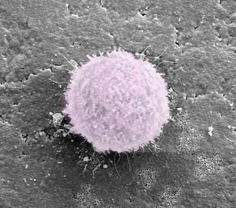 Bone cell growing on one of the materials licensed to ApaTech