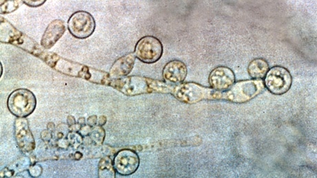 Candida albicans has evolved to 'hide' from our immune system | Copyright: Graham Beards