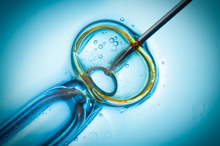 Picture of IVF treatment