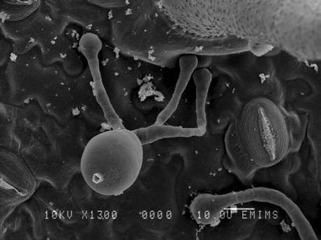 A black and white microscopic image of a sport