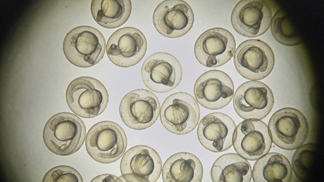 Zebrafish embryos were seen to be affected within hours by the components of the drug Primodos