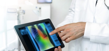 AI in breast cancer screening