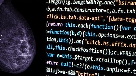 Breast Cancer Awareness: A discussion about AI in breast cancer screening