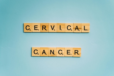 Blue green background with the words Cervical Screening in Scrabble tiles
