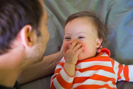 A baby with Down's syndrome smiling and laughing
