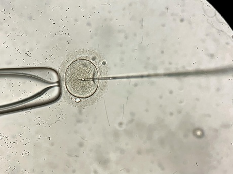Microscope image of an egg being fertilised using IVF
