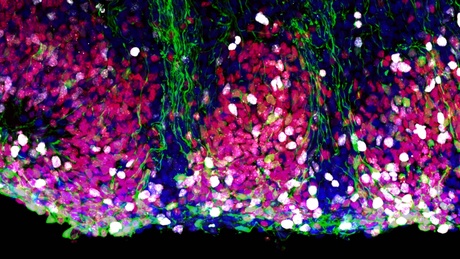 A microscope image of neural stems