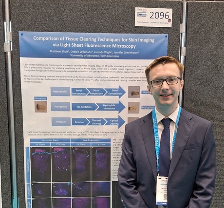 Matthew presenting his poster titled “Comparison of Tissue Clearing Techniques for Skin Imaging via Light Sheet Fluorescence Microscopy”