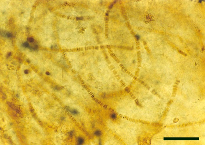 Filaments of the cyanobacterium Archaeothrix oscillatoriformi within a stem of Rhynia gwynne-vaughanii (scale bar = 50µm).