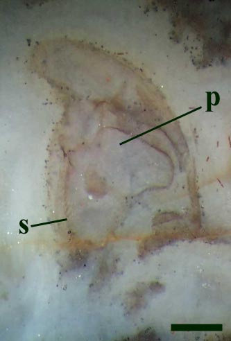 Fragment of the cephalic segment of Heterocrania rhyniensis showing one of the ventral plates (p) with a striated inner margin (s) (scale bar = 500μm).