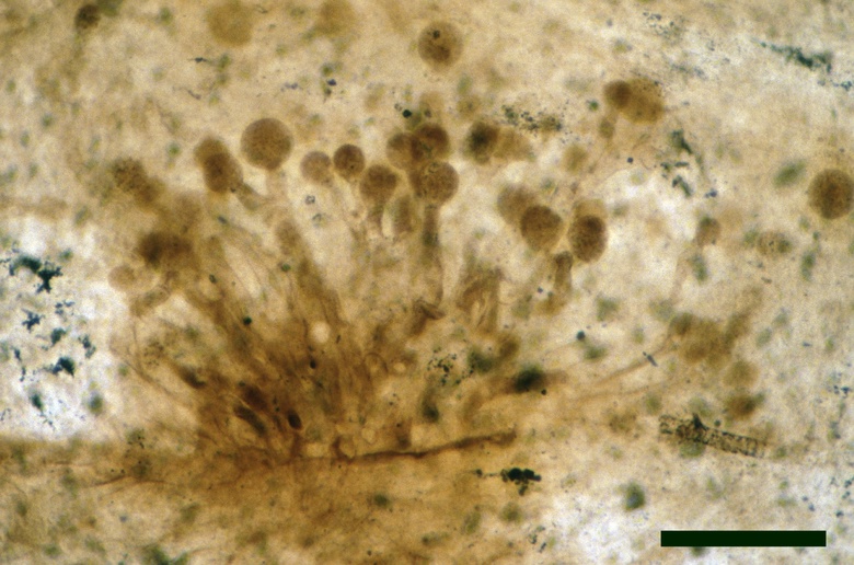 Close up on fungal tuft of Palaeoblastocladia milleri showing numerous zoosporangia (scale bar = 100μm) (Copyright owned by University of Münster).