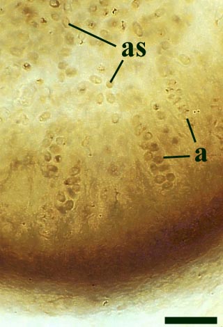 Close up on a mature perithecium showing the asci emerging from the inner wall (a) and ascospores that have already been released (as) (scale bar = 30μm) (Copyright owned by University of Münster).