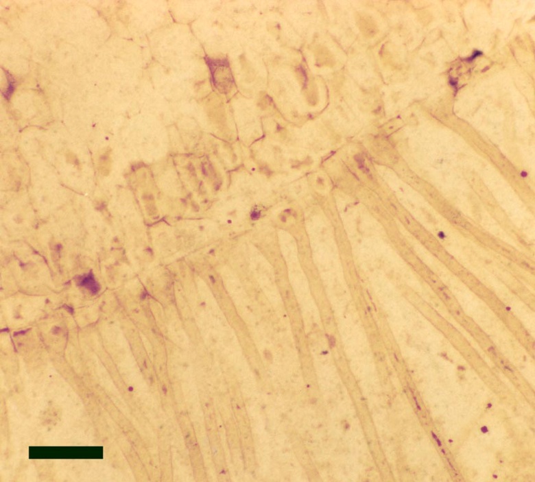 Close up on the rhizoids of Horneophyton lignieri (scale bar = 100μm).