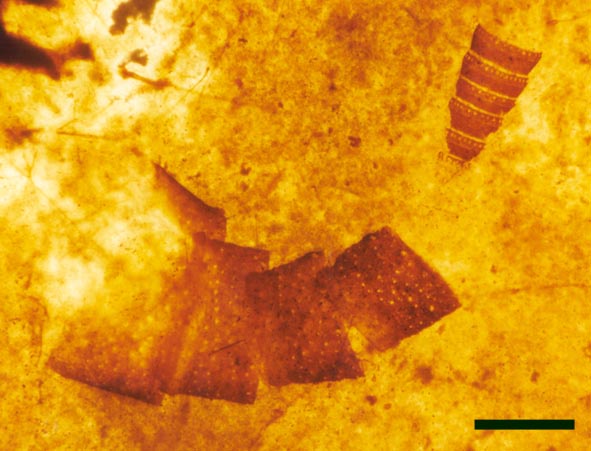 Rhynimonstrum dunlopi showing ring-like segments with sockets (top right) and associated segments of punctate cuticle (centre) (scale bar = 1mm).