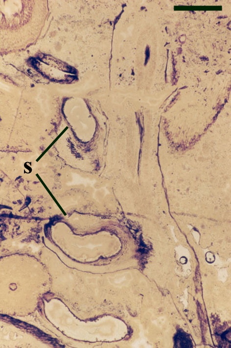 Longitudinal section of a fertile aerial axis with laterally attached sporangia (s) (see below) (scale bar = 2mm).