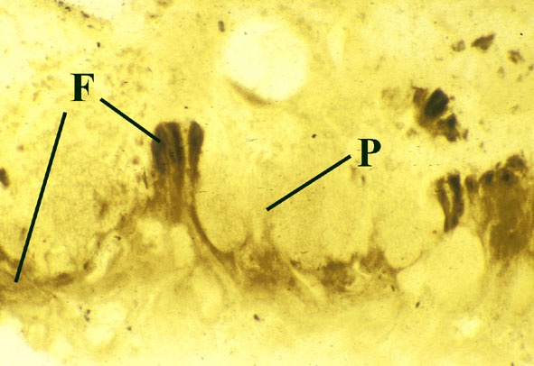 Longitudinal view of the thallus of Winfrenatia reticulata. Tightly aggregated fungal hyphae (F) can be seen (the mycobiont). The surface of the thallus showing a series of pockets (P) with nets of fine hyphae containing the cyanobacterium (the photobiont) (Copyright owned by University of Münster).