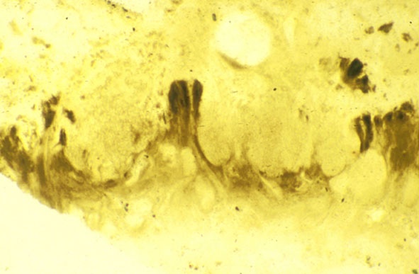The thallus of the cyanolichen Winfrenatia reticulata (Copyright owned by University of Münster).