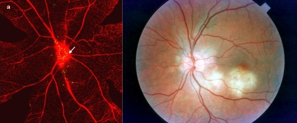 Retinal images of the eye