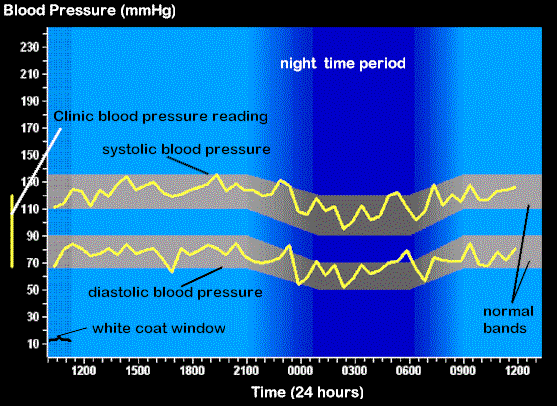 24 Hour Blood Pressure Daily Pattern
