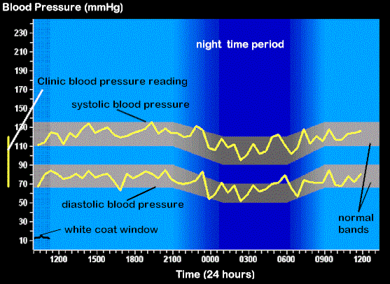 Explanation of ABPM plot