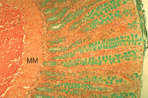 Micrograph of Large Intestine