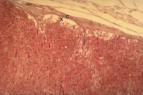 image of the outer cortex of a lymph node