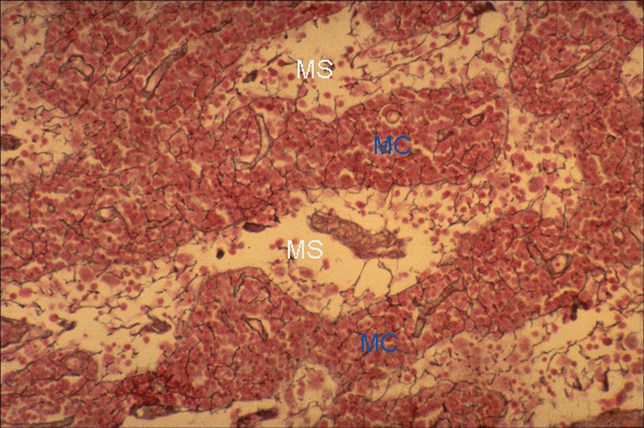 image of the medulla of a lymph node