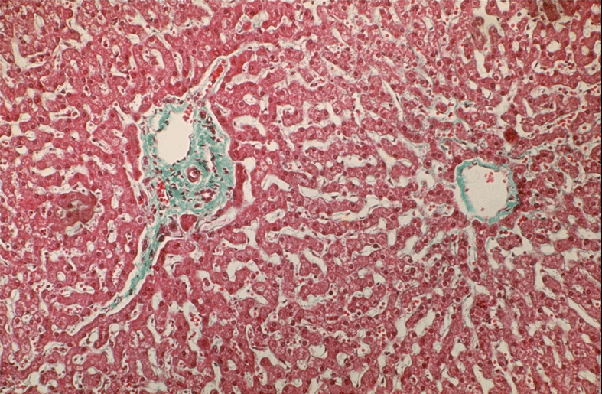 Micrograph of Blood