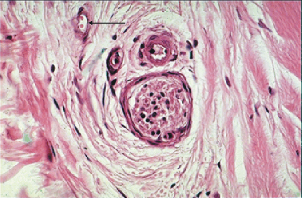 Micrograph of Blood